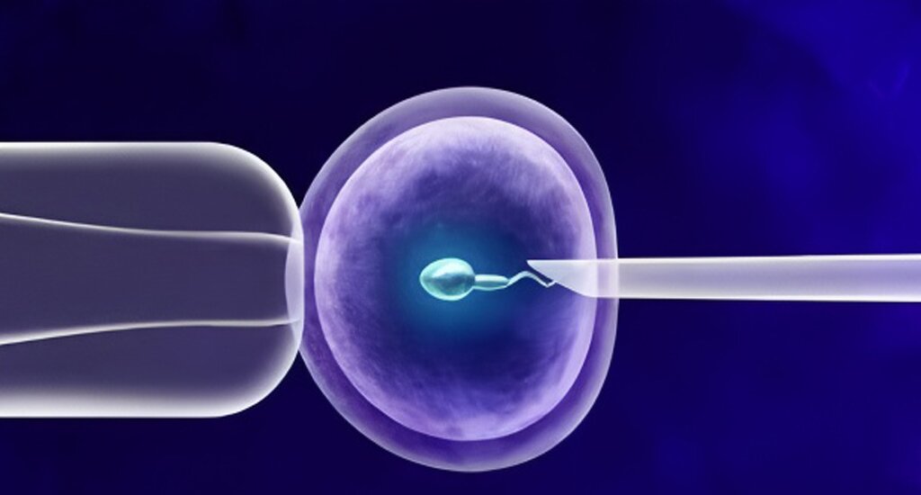 上海代孕：试管成功率：照亮我生命的那束光